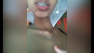 ���वीन पुच्ची सुजलेल्या